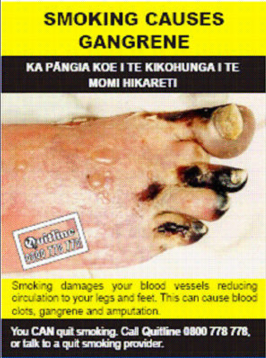 NZ 2008 Health Effects vascular system - diseased organ, peripheral vascular disease, foot, gross